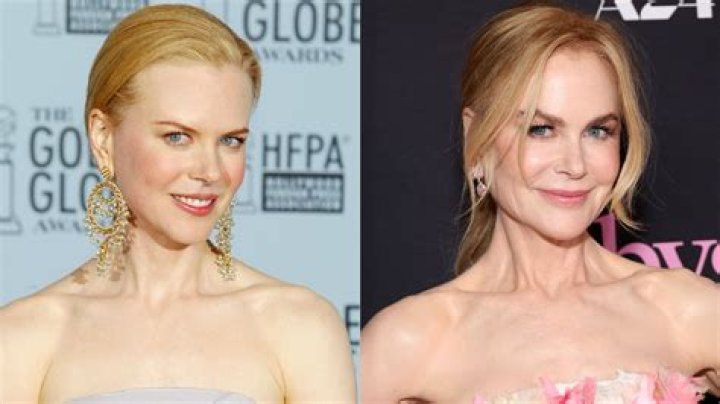 Is Nicole Kidman's Plastic Surgery A Good Or Bad Thing?